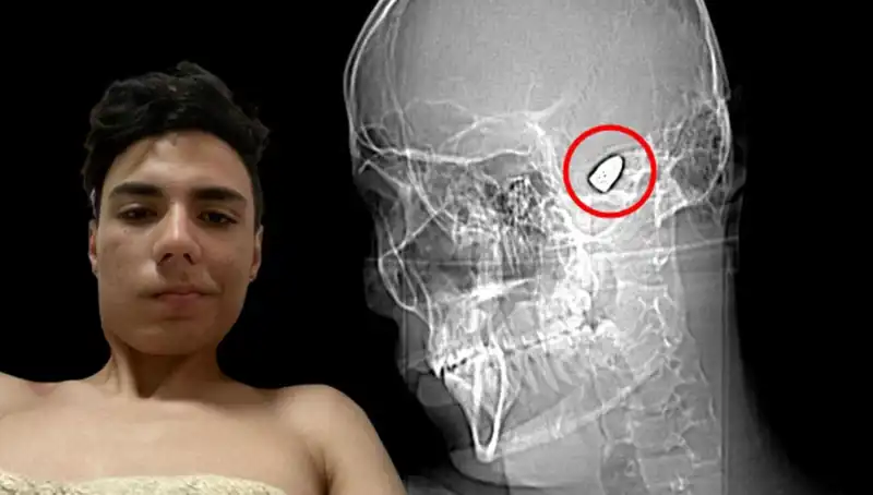 Kafasında Patlayıcı Var Gibi Yaşayanlar: Zihindeki Bomba Tehlikesi