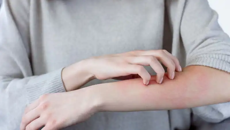 Cilt Kanserinin Belirtilerini Erken Fark Edin: Dermatologlar Uyarıyor!